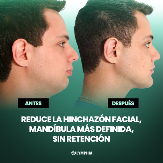 Gotas Lymphia® Hombre