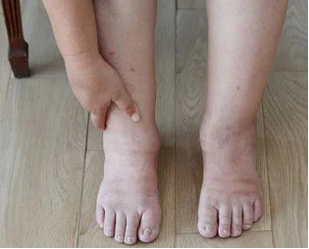 PIERNAS COMO PLOMO